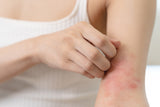 The Inside Scoop on Eczema